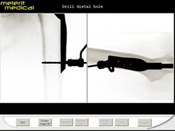 3DSystems-Haptics-Gallery-melerit_image2