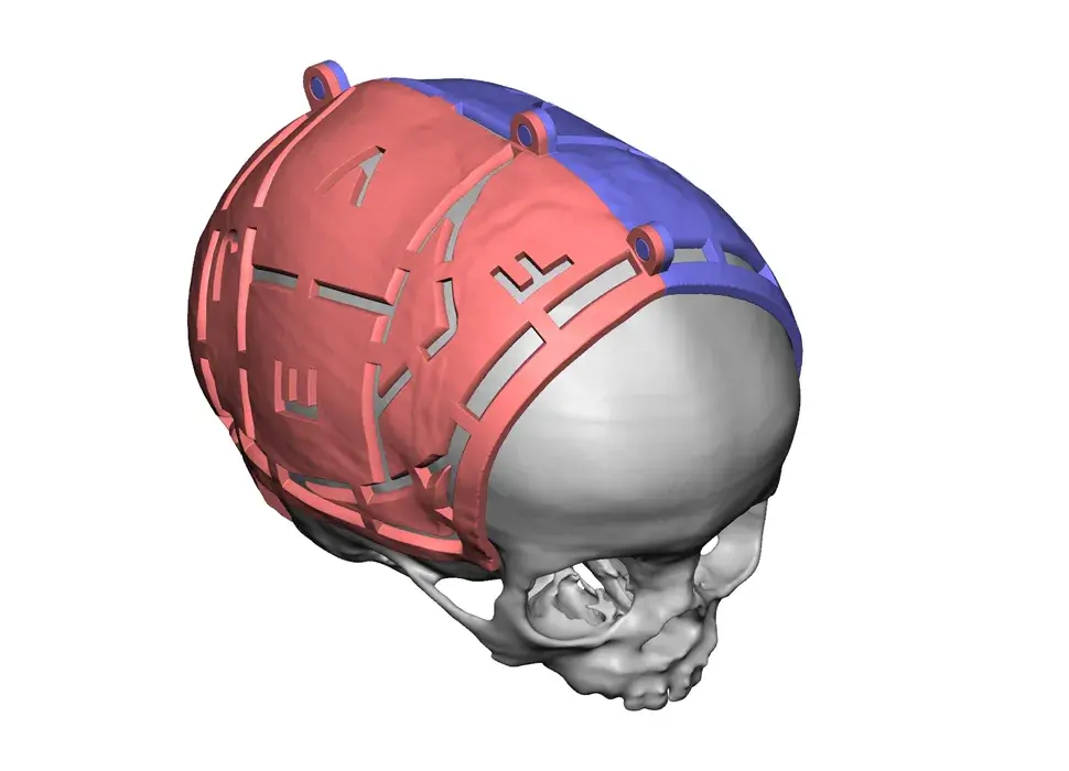 VSP Cranial Pre-Op Guides ISO