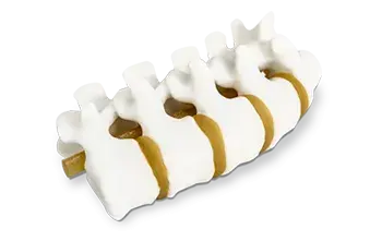 Modèle anatomique de la colonne vertébrale imprimée en 3D par 3D Systems