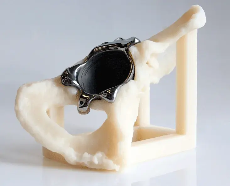 Modèle en os SLA de santé de 3D Systems avec tri-flange en titane