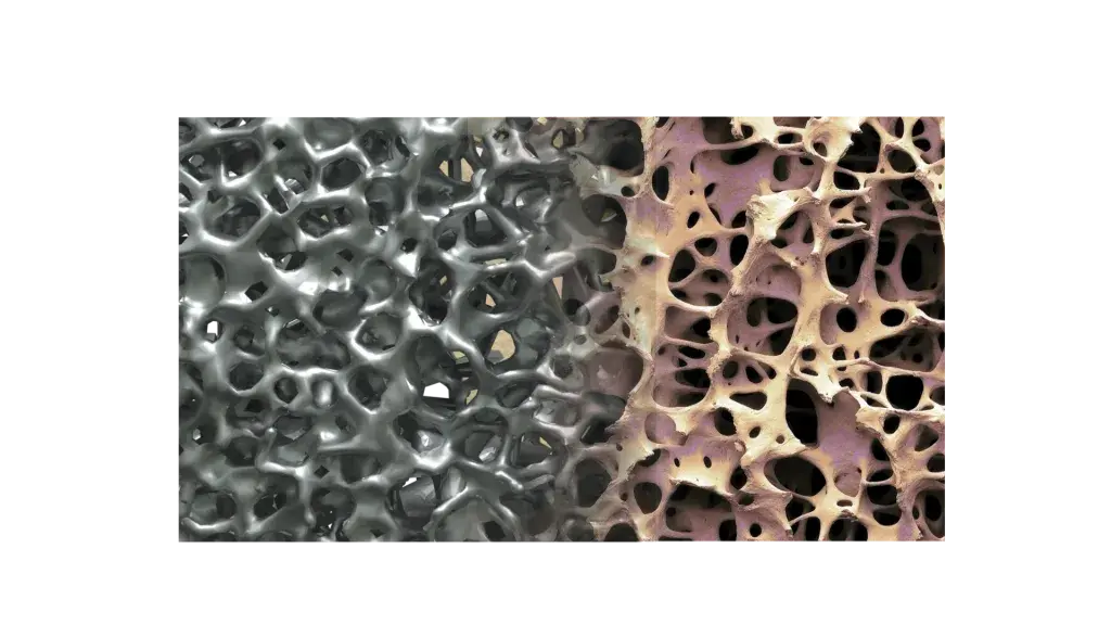 La conception de la gamme d'implants rachidiens Modulus de NuVasive vise à améliorer les résultats cliniques des patients porteurs d'implants rachidiens.