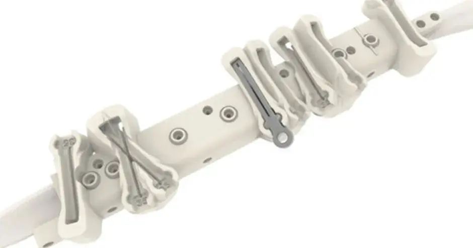 3D Printed VSP CMF SLA fibula guide