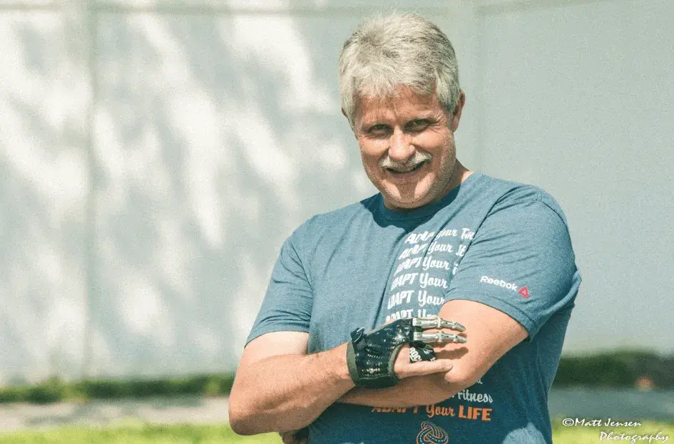 Jeff Soelberg portant sa prothèse de main partielle élaborée par Point Designs