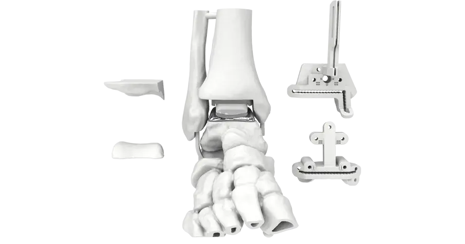 PHS Ankle Model Rendering