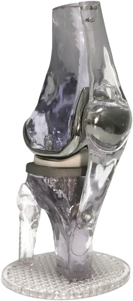 Genou imprimé en 3D