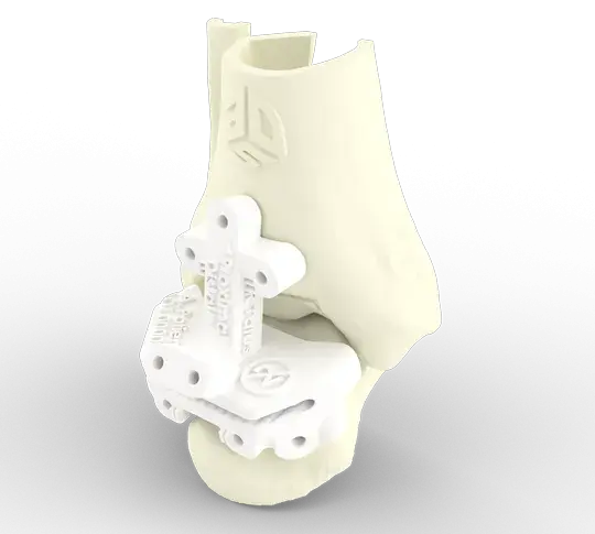 Guide spécifique au patient pour cheville