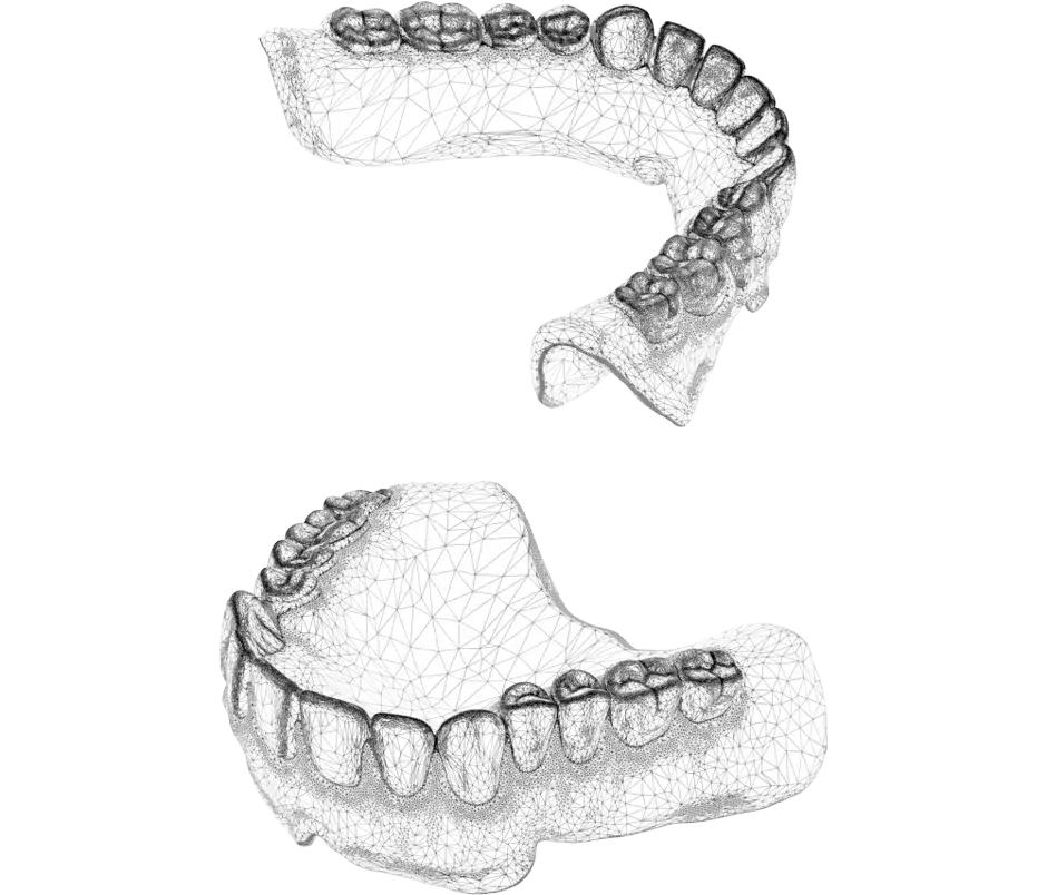 Production NextDent - Fichier CAO