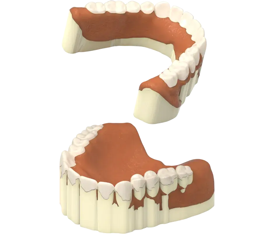 Production NextDent - Retrait des supports