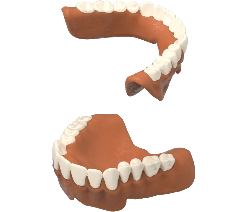 Production NextDent - Cire éliminée