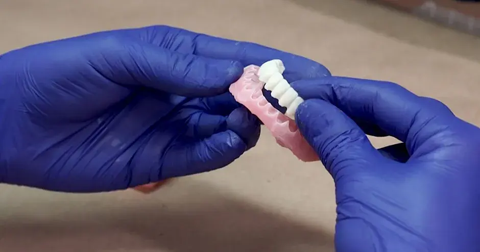 Dentiste tenant des prothèses dentaires imprimées en 3D
